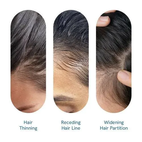 Be Bodywise Be Bodywise Hair Growth Serum Roll On - With 3% Rosemary for New Hair Growth - Pack of 2 At Nykaa, Best Beauty Products Online - image 5