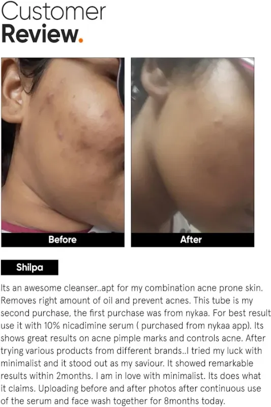 Minimalist Minimalist Salicylic Acid LHA Face Cleanser - image 8