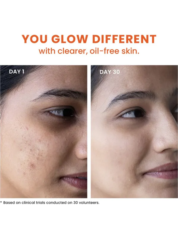 Foxtale Acne Control Cleanser